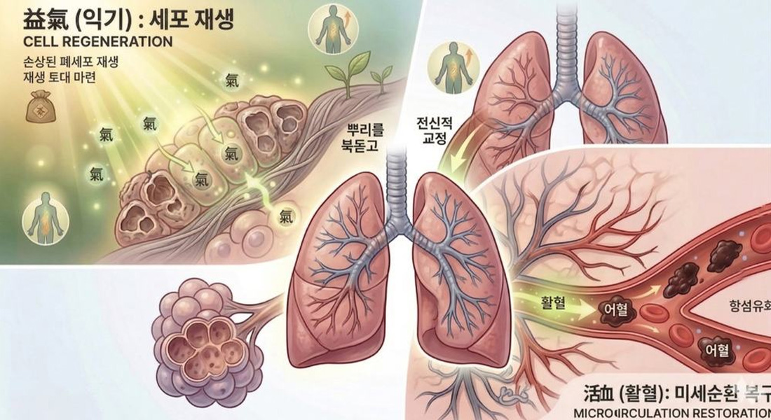 폐섬유화증 03