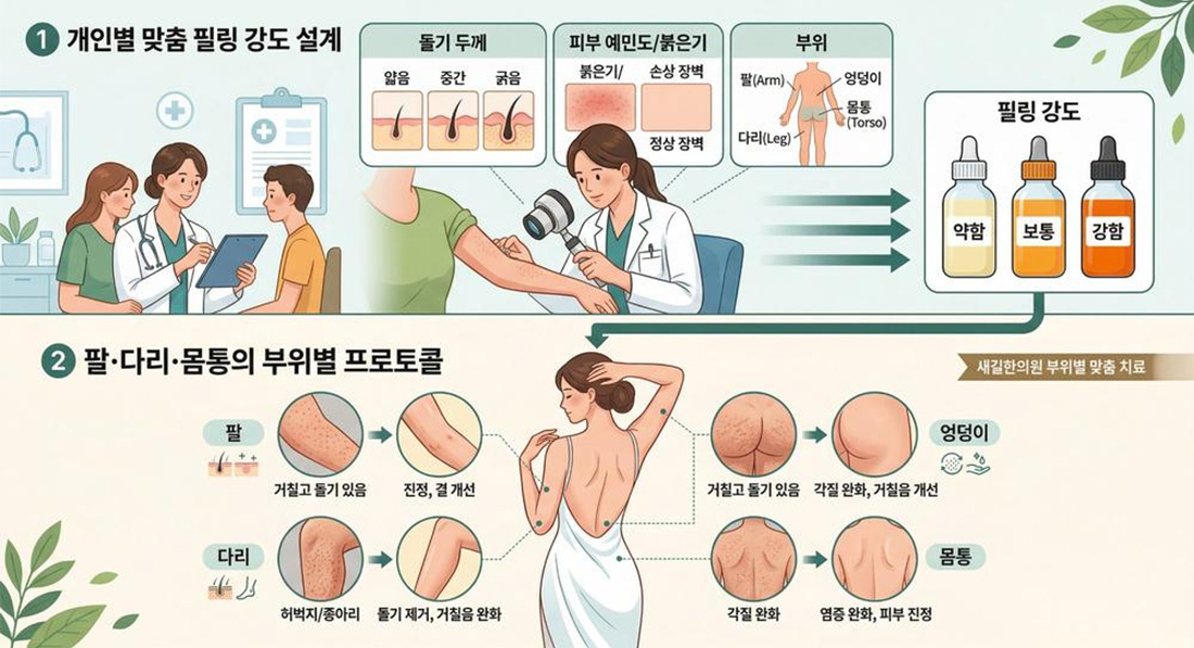 모공각화증 02